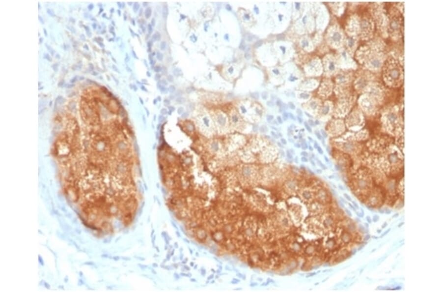 Immunohistochemistry - Anti-Tyrosinase Antibody [TYR/3826] (A277823) - Antibodies.com
