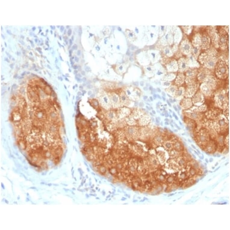 Immunohistochemistry - Anti-Tyrosinase Antibody [TYR/3826] (A277823) - Antibodies.com