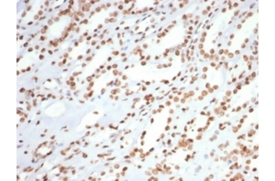 Immunohistochemistry - Anti-Ku80 Antibody [XRCC5/7315] (A277824) - Antibodies.com