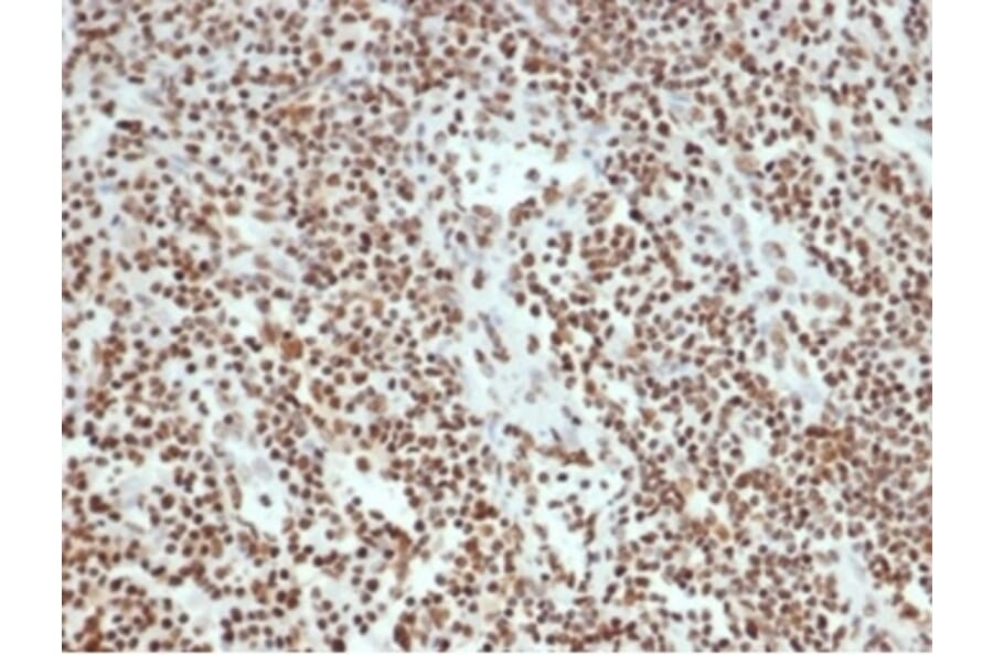 Immunohistochemistry - Anti-Ku80 Antibody [XRCC5/7315] (A277824) - Antibodies.com