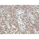 Immunohistochemistry - Anti-Ku80 Antibody [XRCC5/7315] (A277824) - Antibodies.com