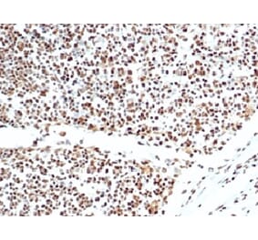 Immunohistochemistry - Anti-Ku80 Antibody [XRCC5/7317] (A277825) - Antibodies.com