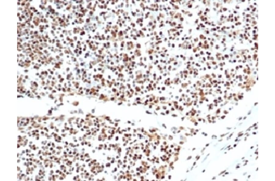 Immunohistochemistry - Anti-Ku80 Antibody [XRCC5/7317] (A277825) - Antibodies.com