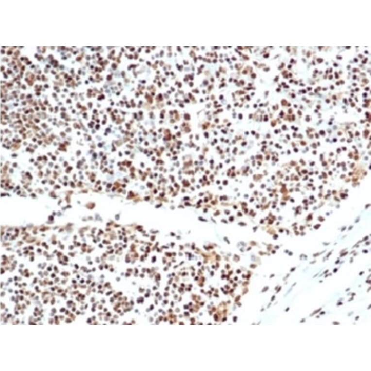 Immunohistochemistry - Anti-Ku80 Antibody [XRCC5/7317] (A277825) - Antibodies.com