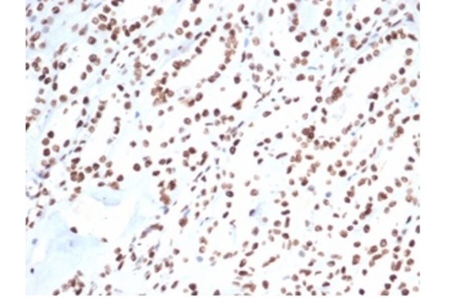 Immunohistochemistry - Anti-Ku80 Antibody [XRCC5/7317] (A277825) - Antibodies.com