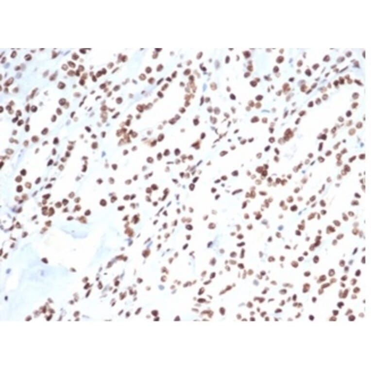 Immunohistochemistry - Anti-Ku80 Antibody [XRCC5/7317] (A277825) - Antibodies.com