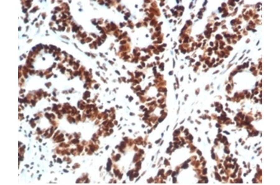 Immunohistochemistry - Anti-Ku80 Antibody [XRCC5/7317] (A277825) - Antibodies.com
