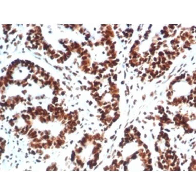 Immunohistochemistry - Anti-Ku80 Antibody [XRCC5/7317] (A277825) - Antibodies.com