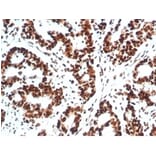 Immunohistochemistry - Anti-Ku80 Antibody [XRCC5/7317] (A277825) - Antibodies.com