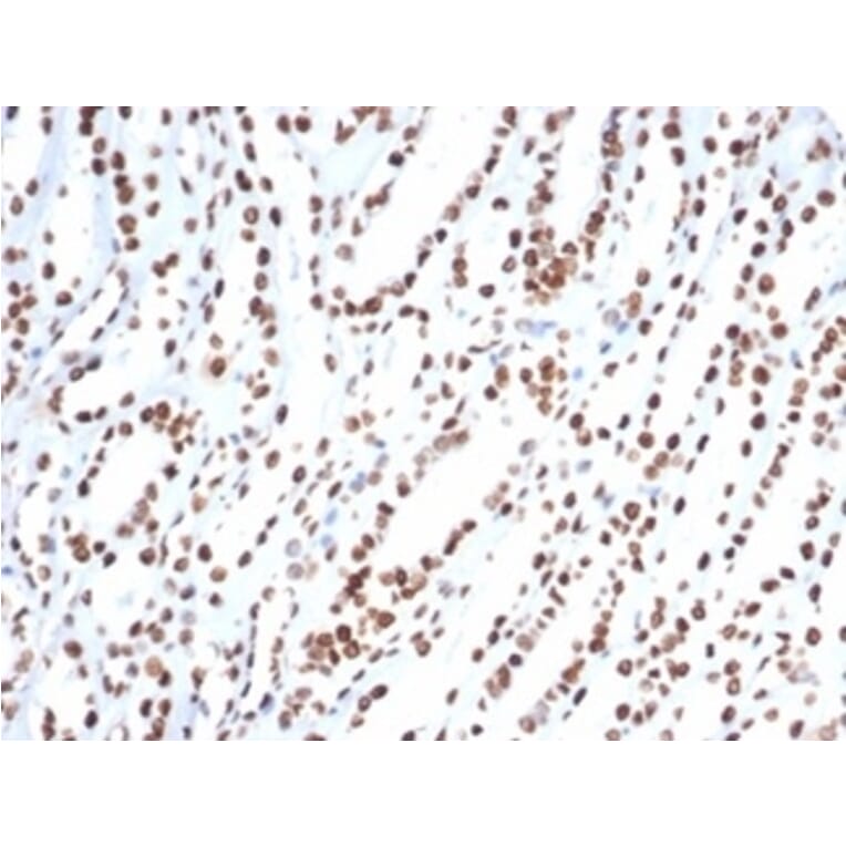 Immunohistochemistry - Anti-Ku80 Antibody [XRCC5/7318] (A277826) - Antibodies.com