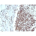 Immunohistochemistry - Anti-Ku80 Antibody [XRCC5/7318] (A277826) - Antibodies.com