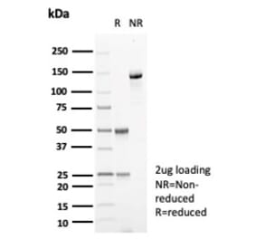 SDS-PAGE - Anti-Carbonic Anhydrase VIII Antibody [CA8/6572] (A277827) - Antibodies.com