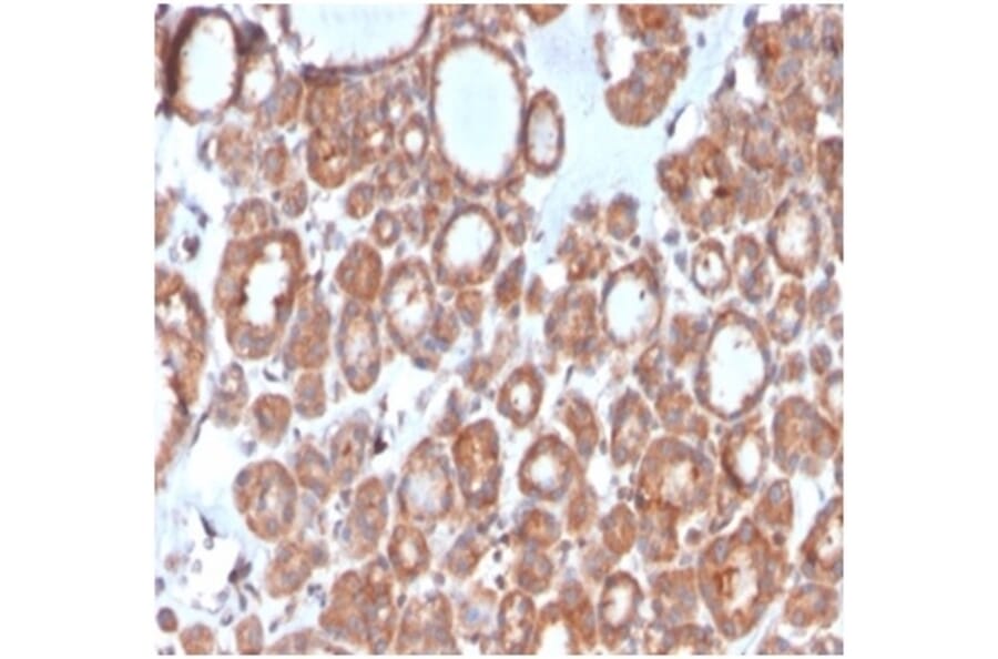 Immunohistochemistry - Anti-Calcitonin Antibody [CALCA/3310] (A277829) - Antibodies.com