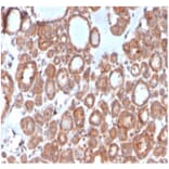 Immunohistochemistry - Anti-Calcitonin Antibody [CALCA/3310] (A277829) - Antibodies.com