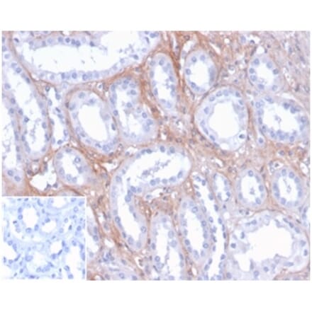 Immunohistochemistry - Anti-FGF23 Antibody [FGF23/4171] (A277830) - Antibodies.com