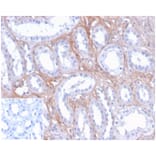Immunohistochemistry - Anti-FGF23 Antibody [FGF23/4171] (A277830) - Antibodies.com