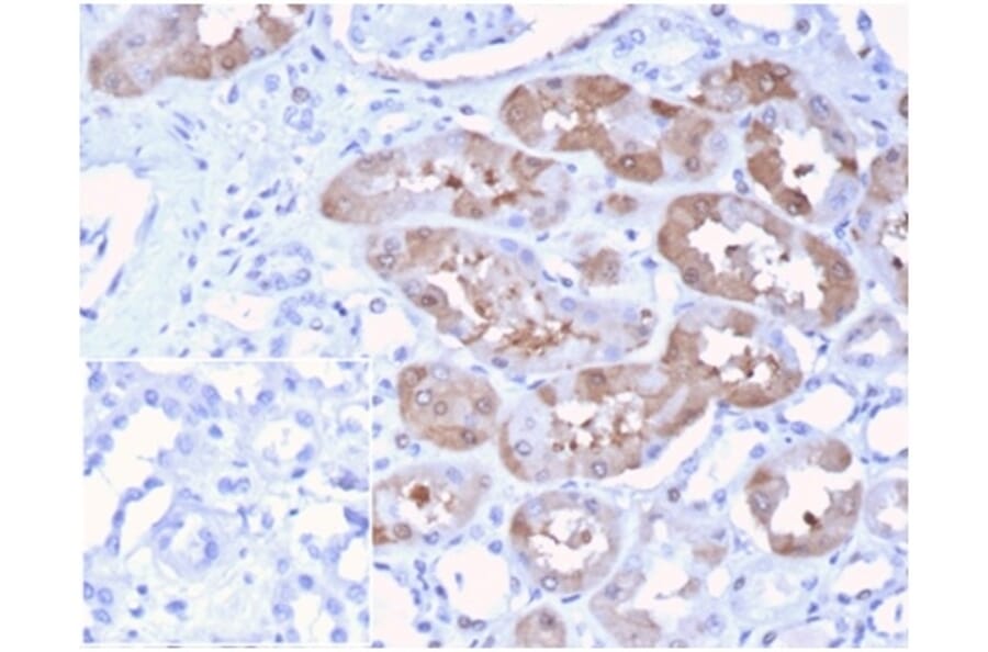 Immunohistochemistry - Anti-FGF23 Antibody [FGF23/4174] (A277831) - Antibodies.com