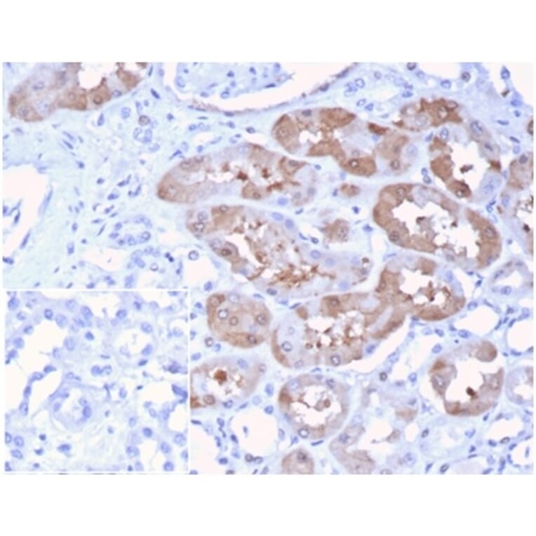 Immunohistochemistry - Anti-FGF23 Antibody [FGF23/4174] (A277831) - Antibodies.com