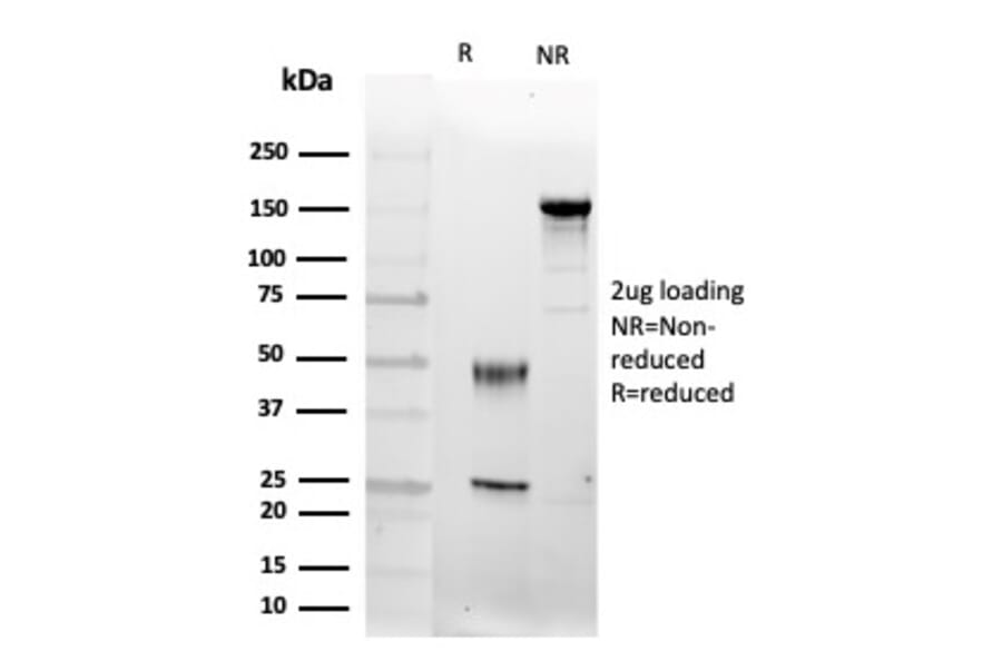 SDS-PAGE - Anti-FGF23 Antibody [FGF23/4174] (A277831) - Antibodies.com