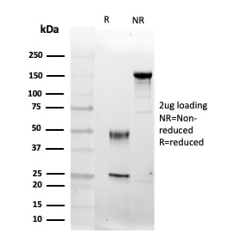 SDS-PAGE - Anti-FGF23 Antibody [FGF23/4174] (A277831) - Antibodies.com