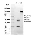 SDS-PAGE - Anti-FGF23 Antibody [FGF23/4174] (A277831) - Antibodies.com