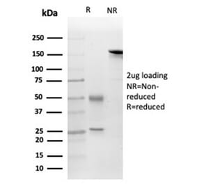 SDS-PAGE - Anti-FGF23 Antibody [FGF23/4169] (A277832) - Antibodies.com