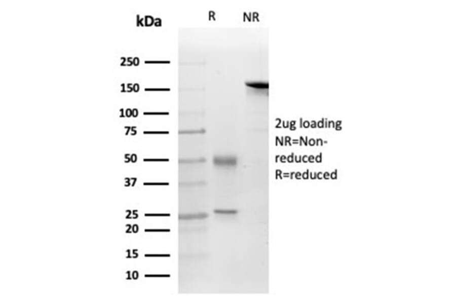 SDS-PAGE - Anti-FGF23 Antibody [FGF23/4169] (A277832) - Antibodies.com