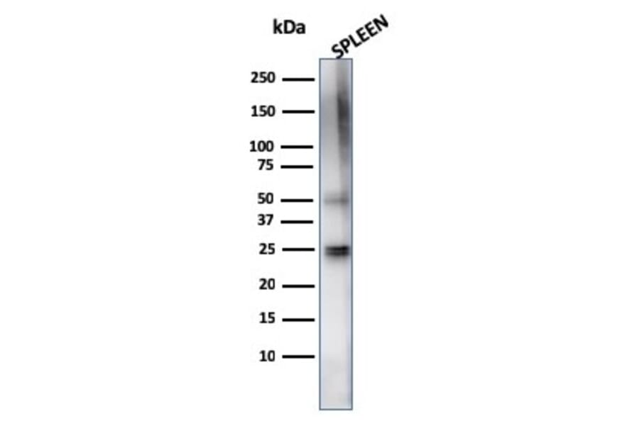 Western Blot - Anti-TIM3 Antibody [TIM3/4024] (A277833) - Antibodies.com