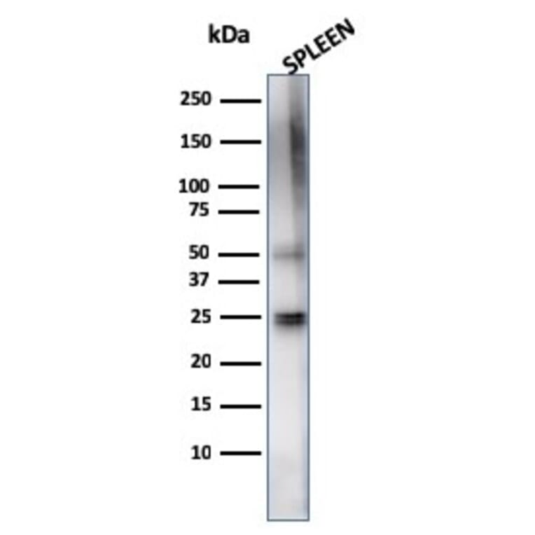 Western Blot - Anti-TIM3 Antibody [TIM3/4024] (A277833) - Antibodies.com
