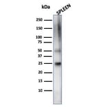 Western Blot - Anti-TIM3 Antibody [TIM3/4024] (A277833) - Antibodies.com