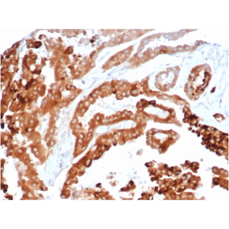 Immunohistochemistry - Anti-TIM3 Antibody [TIM3/4024] (A277833) - Antibodies.com
