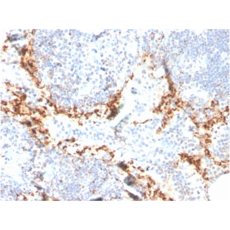 Immunohistochemistry - Anti-TIM3 Antibody [TIM3/4024] (A277833) - Antibodies.com