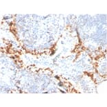 Immunohistochemistry - Anti-TIM3 Antibody [TIM3/4024] (A277833) - Antibodies.com