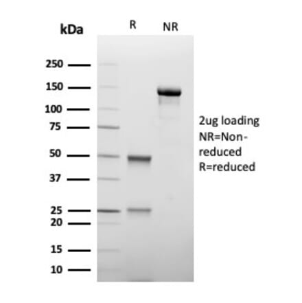 SDS-PAGE - Anti-TIM3 Antibody [TIM3/4027] (A277834) - Antibodies.com
