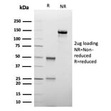 SDS-PAGE - Anti-TIM3 Antibody [TIM3/4027] (A277834) - Antibodies.com
