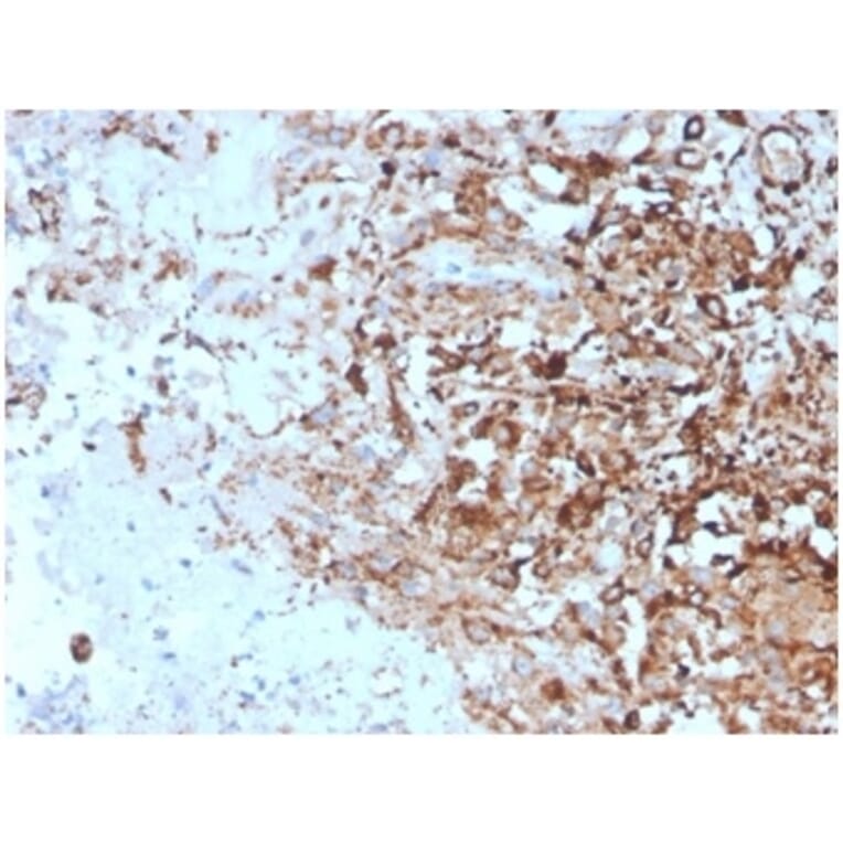 Immunohistochemistry - Anti-TIM3 Antibody [TIM3/4027] (A277834) - Antibodies.com