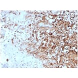 Immunohistochemistry - Anti-TIM3 Antibody [TIM3/4027] (A277834) - Antibodies.com
