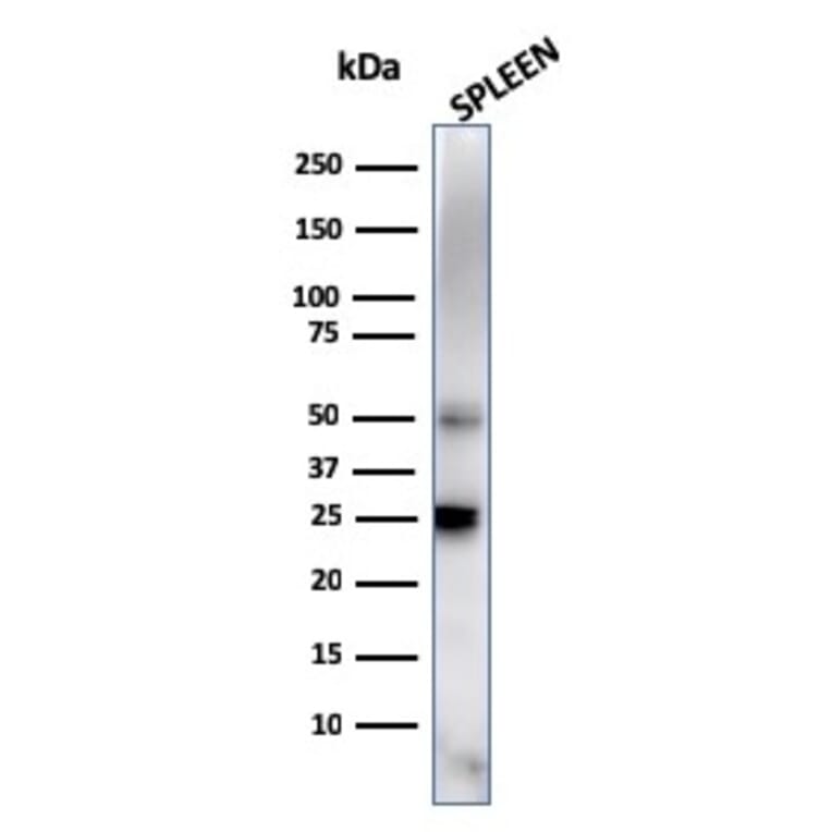 Western Blot - Anti-TIM3 Antibody [TIM3/4027] (A277834) - Antibodies.com