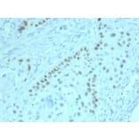 Immunohistochemistry - Anti-p63 Antibody [PCRP-TP63-2G3] (A277835) - Antibodies.com