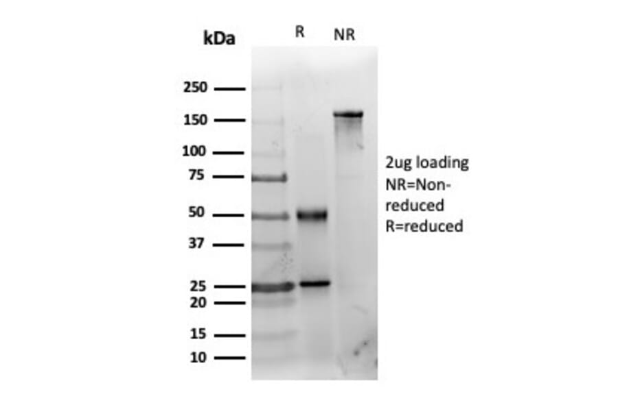 SDS-PAGE - Anti-HDAC3 Antibody [PCRP-HDAC3-2D4] (A277838) - Antibodies.com
