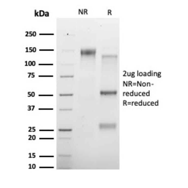 SDS-PAGE - Anti-HDAC3 Antibody [PCRP-HDAC3-3C9] (A277839) - Antibodies.com