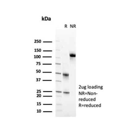 SDS-PAGE - Anti-CD2 Antibody [LFA2/7102] (A277840) - Antibodies.com