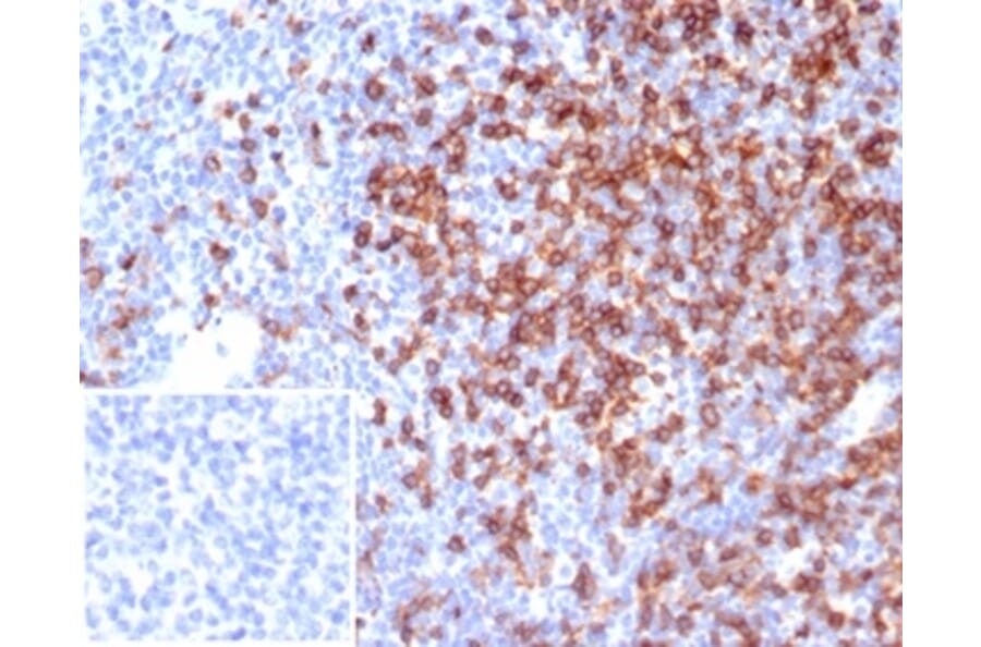 Immunohistochemistry - Anti-CD4 Antibody [CD4/7142] (A277841) - Antibodies.com