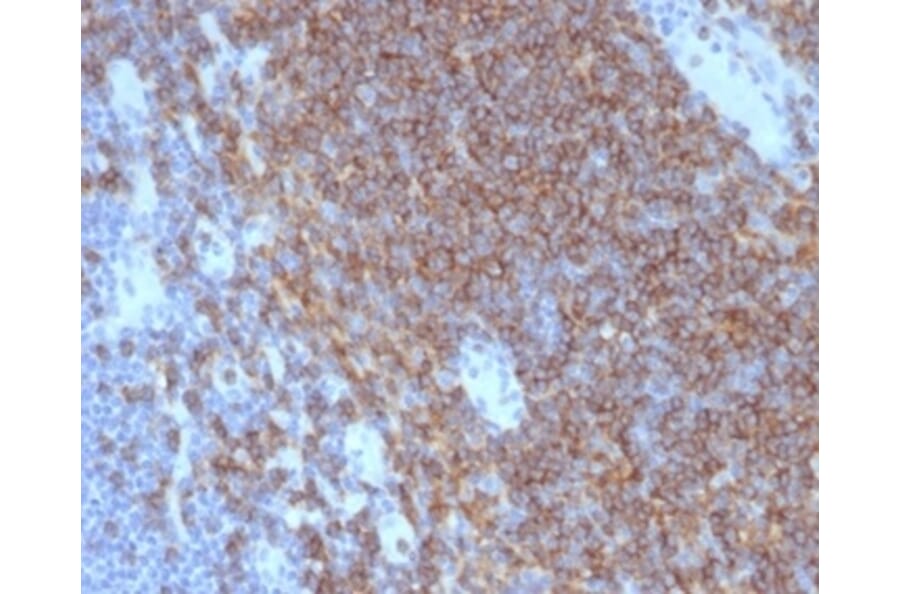 Immunohistochemistry - Anti-CD4 Antibody [CD4/7142] (A277841) - Antibodies.com