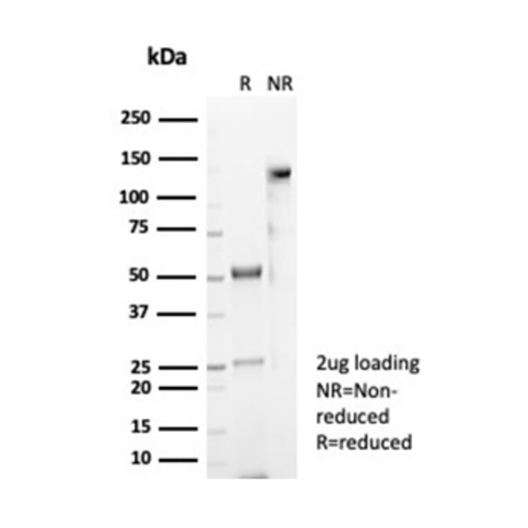 SDS-PAGE - Anti-CD4 Antibody [CD4/7144] (A277842) - Antibodies.com