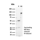 SDS-PAGE - Anti-CD4 Antibody [CD4/7144] (A277842) - Antibodies.com