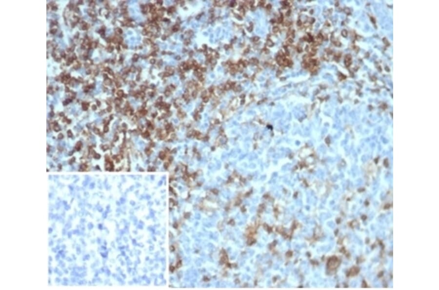 Immunohistochemistry - Anti-CD4 Antibody [CD4/7144] (A277842) - Antibodies.com