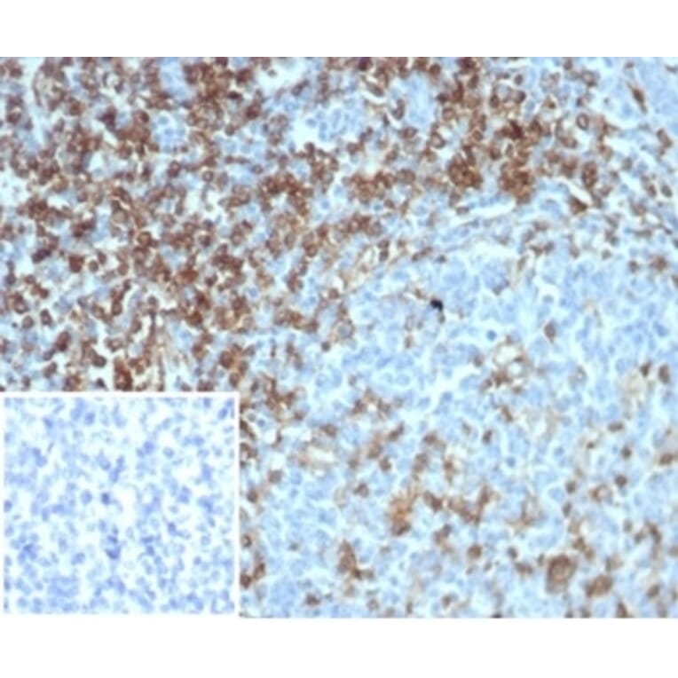 Immunohistochemistry - Anti-CD4 Antibody [CD4/7144] (A277842) - Antibodies.com