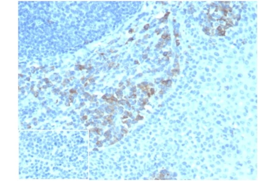 Immunohistochemistry - Anti-CD5L Antibody [CD5L/4420] (A277843) - Antibodies.com