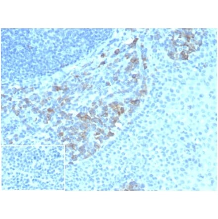Immunohistochemistry - Anti-CD5L Antibody [CD5L/4420] (A277843) - Antibodies.com